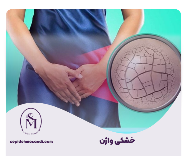 خشکی واژن