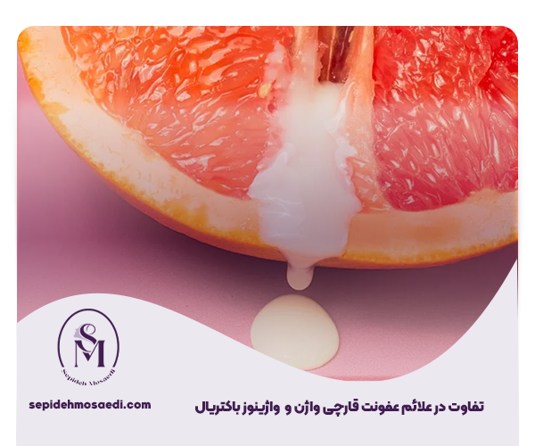 تفاوت عفونت قارچی و باکتریایی واژن، بررسی علائم، ترشحات و درمان 1 تفاوت در علائم عفونت قارچی واژن و واژینوز باکتریال