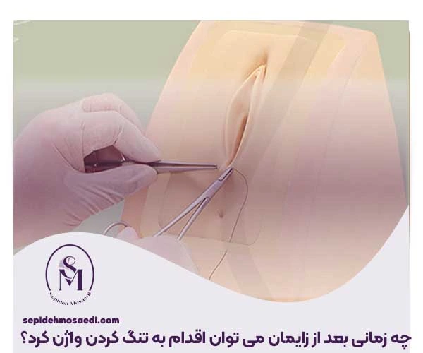 تنگ کردن واژن بعد از بارداری، بررسی علمی و پزشکی بهترین روش ها 1 چه زمانی بعد از زایمان می توان اقدام به تنگ کردن واژن کرد؟