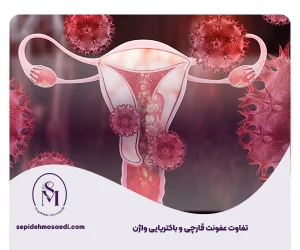 وبلاگ 18 تفاوت عفونت قارچی و باکتریایی واژن