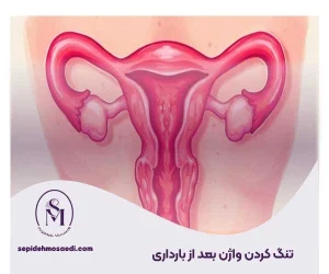 وبلاگ 13 تنگ کردن واژن بعد از بارداری