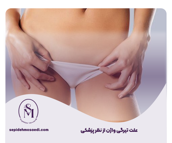 علت تیرگی واژن از نظر پزشکی