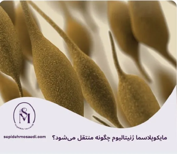 مایکوپلاسما ژنیتالیوم چیست؟ علائم، روش تشخیص و درمان قطعی در زنان 1 مایکوپلاسما ژنیتالیوم چگونه منتقل میشود؟