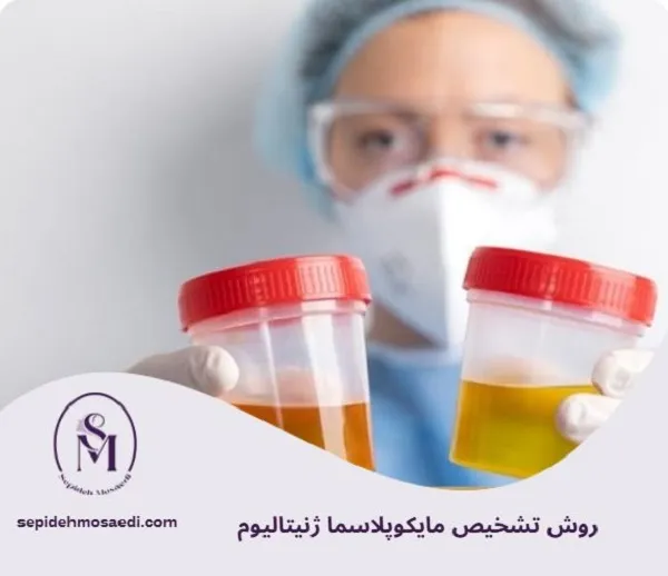 مایکوپلاسما ژنیتالیوم چیست؟ علائم، روش تشخیص و درمان قطعی در زنان 3 روش تشخیص مایکوپلاسما ژنیتالیوم