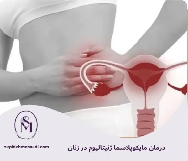 مایکوپلاسما ژنیتالیوم چیست؟ علائم، روش تشخیص و درمان قطعی در زنان 4 درمان مایکوپلاسما ژنیتالیوم در زنان