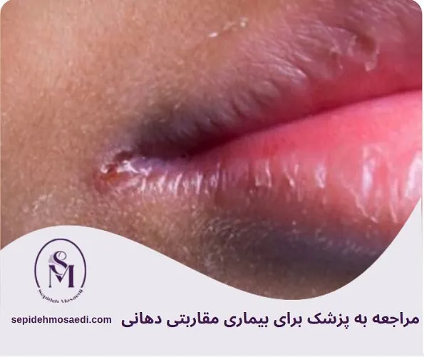 بیماری مقاربتی دهانی چیست؟ علائم، راههای انتقال و درمان کامل 6 چه زمانی باید به پزشک مراجعه کنیم؟