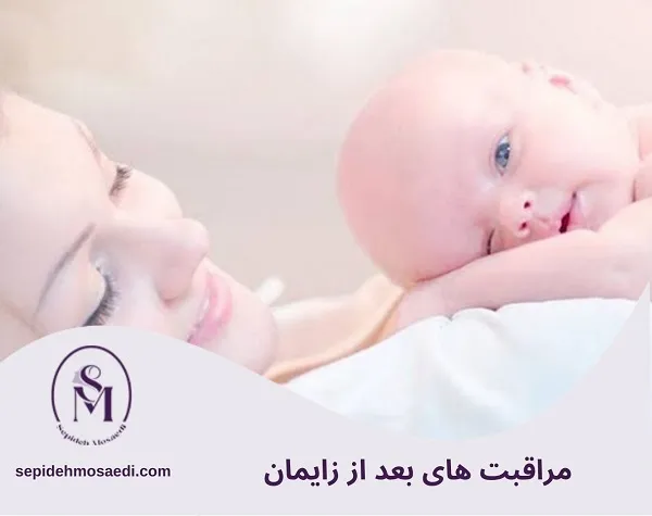 مراقبت های بعد از زایمان