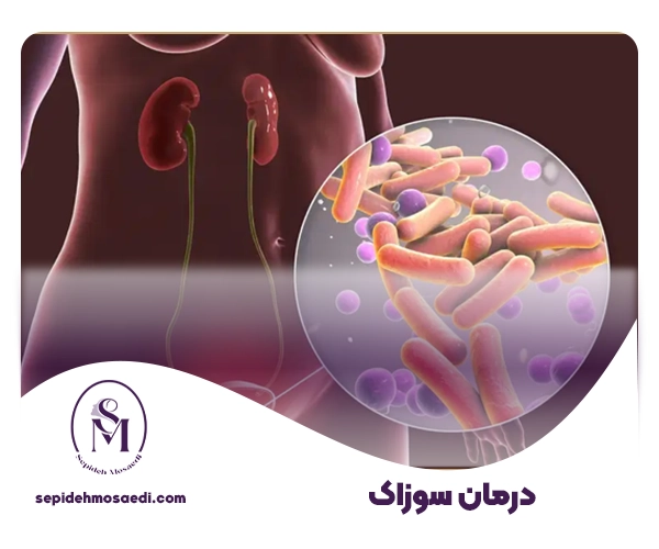 درمان سوزاک چیست؟ 1 بیماری سوزاک