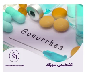 سپیده مساعدی جراحی زیبایی زنان 31 تشخیص سوزاک
