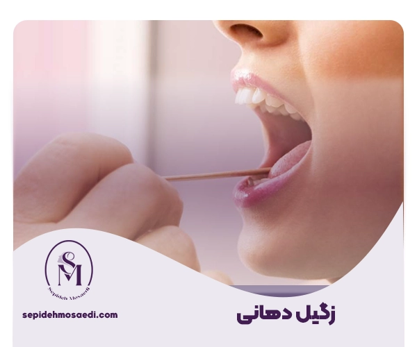 زگیل دهانی چیست و چگونه منتقل می شود؟ 2 تست زگیل دهانی