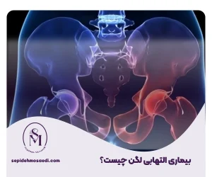 وبلاگ 7 بیماری التهابی لگن