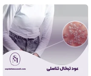 سپیده مساعدی جراحی زیبایی زنان 30 عود تبخال تناسلی