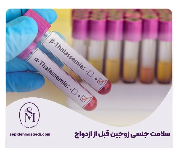 سلامت جنسی زوجین قبل از ازدواج؛ چک لیست کامل آزمایشهای لازم 2 آزمایشهای قبل از ازدواج
