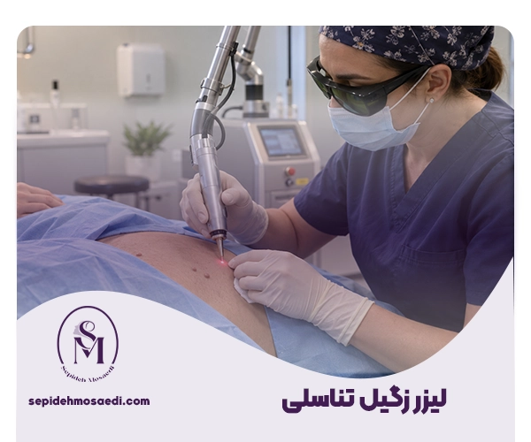 لیزر زگیل تناسلی