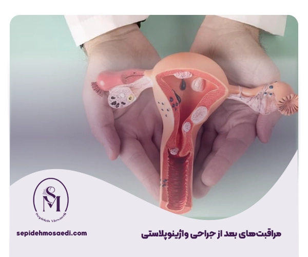 جراحی واژینوپلاستی چگونه انجام می شود؟ 1 مراقبتهای بعد از جراحی واژینوپلاستی