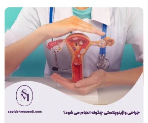 سپیده مساعدی جراحی زیبایی زنان 31 جراحی واؤینوپلاستی